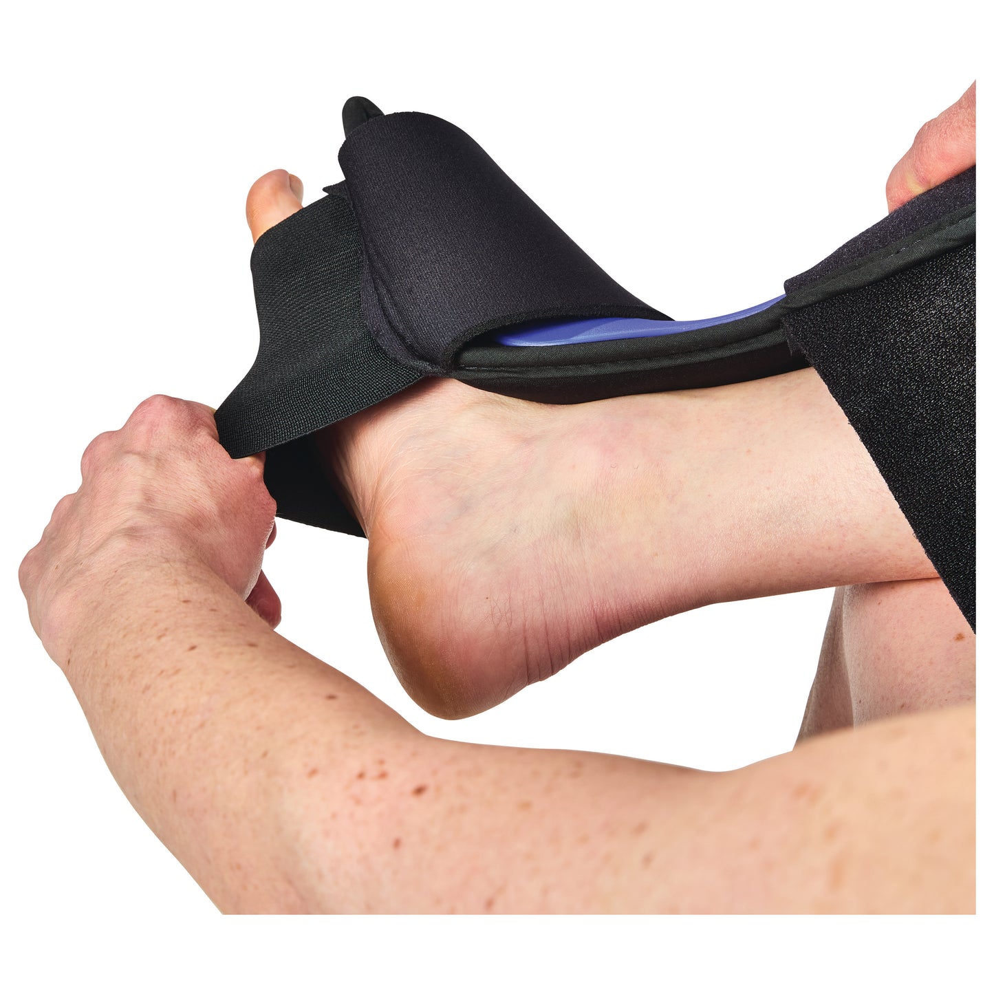 AliMed® FREEDOM® Dorsal PF Night Splint
