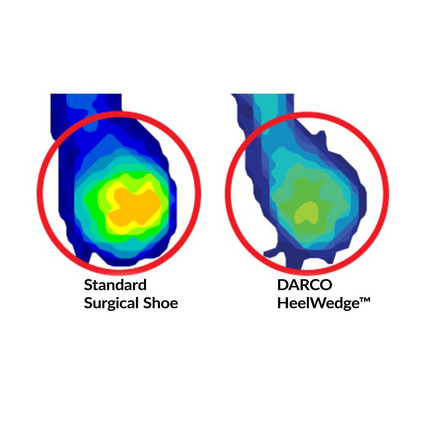 DARCO® HeelWedge™ Healing Shoe