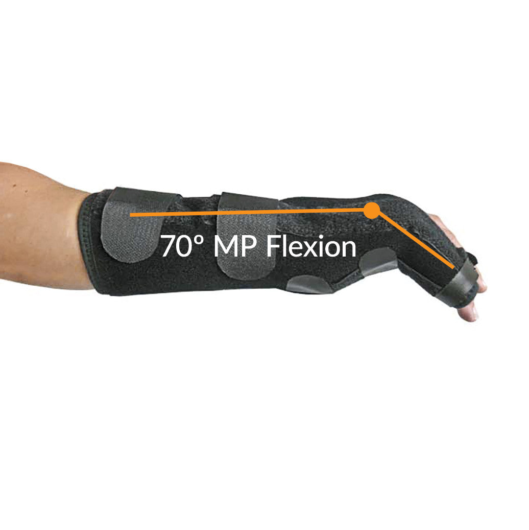 A person wearing an EZY Wrap Boxer Fracture Brace, showing 70� MP flexion, with straps for support and stabilization.
