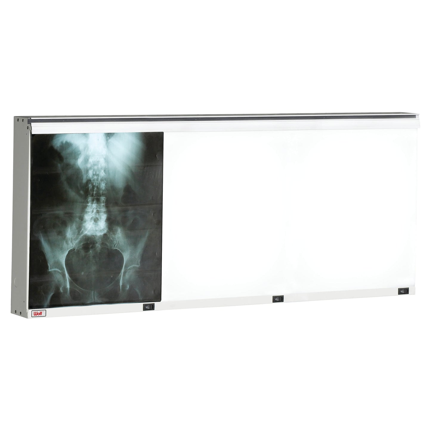 Wall-mounted X-ray viewer displaying a spine and pelvis X-ray on the left. The product is named Wolf Econoline Illuminator.