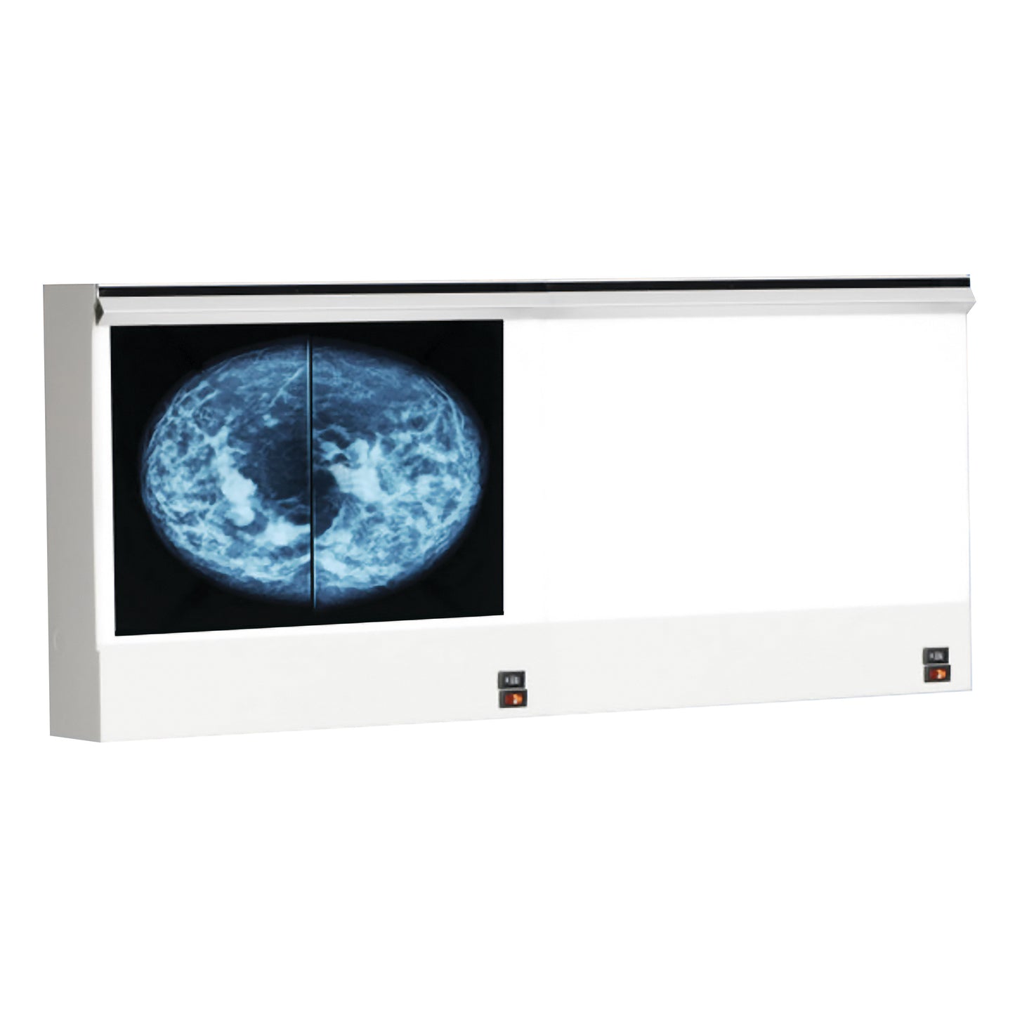 VuPlus Mammography Viewer, Double, 38-3/16"W x 11-3/8"H Viewing Area
