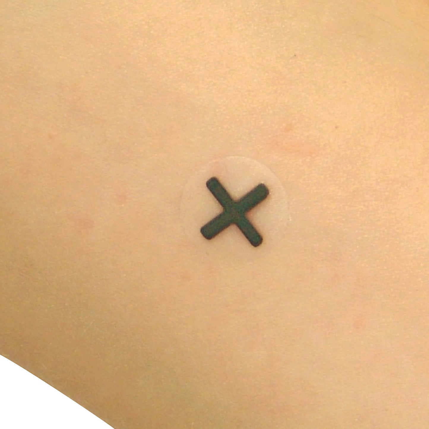 Indicator Radiopaque Marker, Cross, 130/Box
