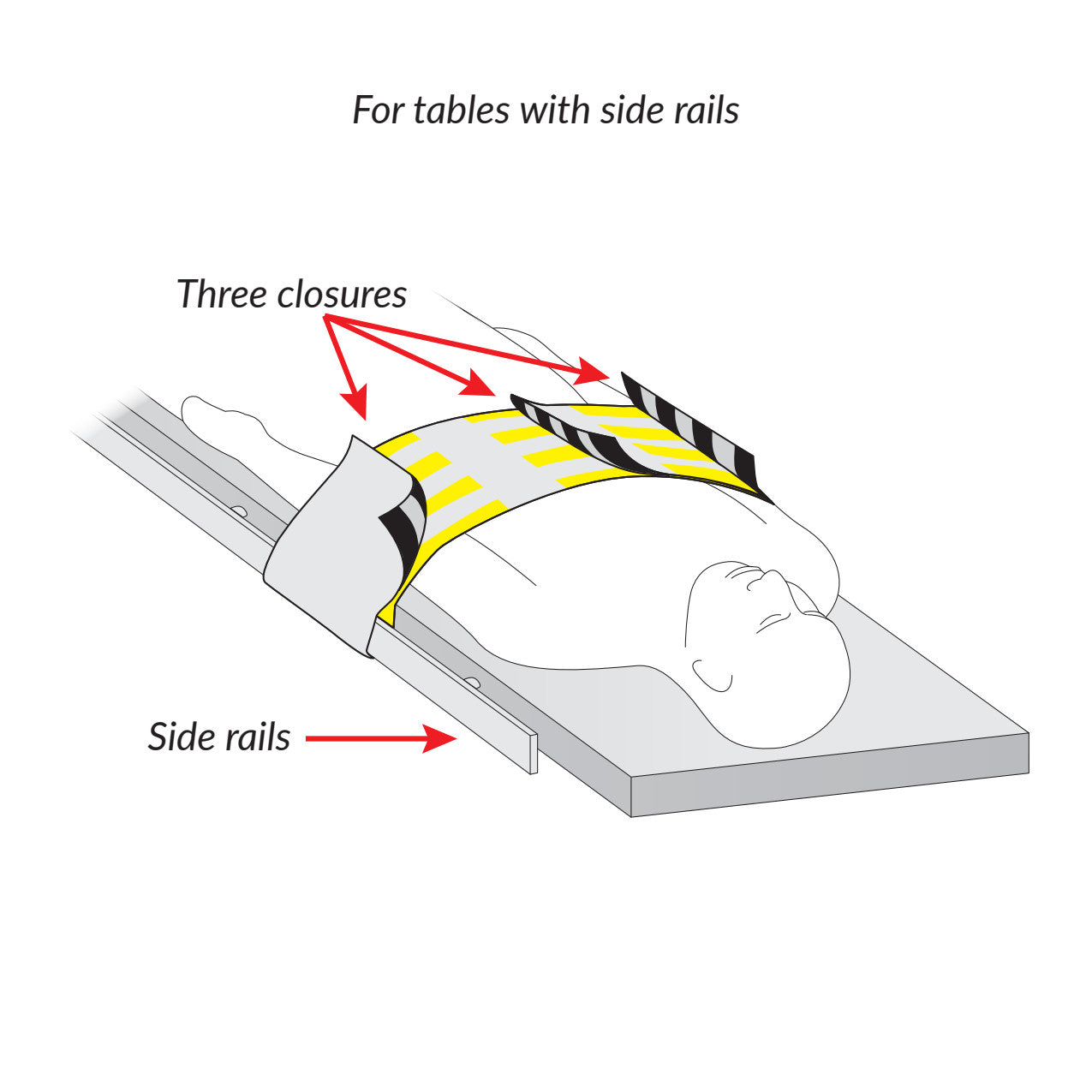 AliMed® Radiolucent Abdominal Immobilizer with Three Closures