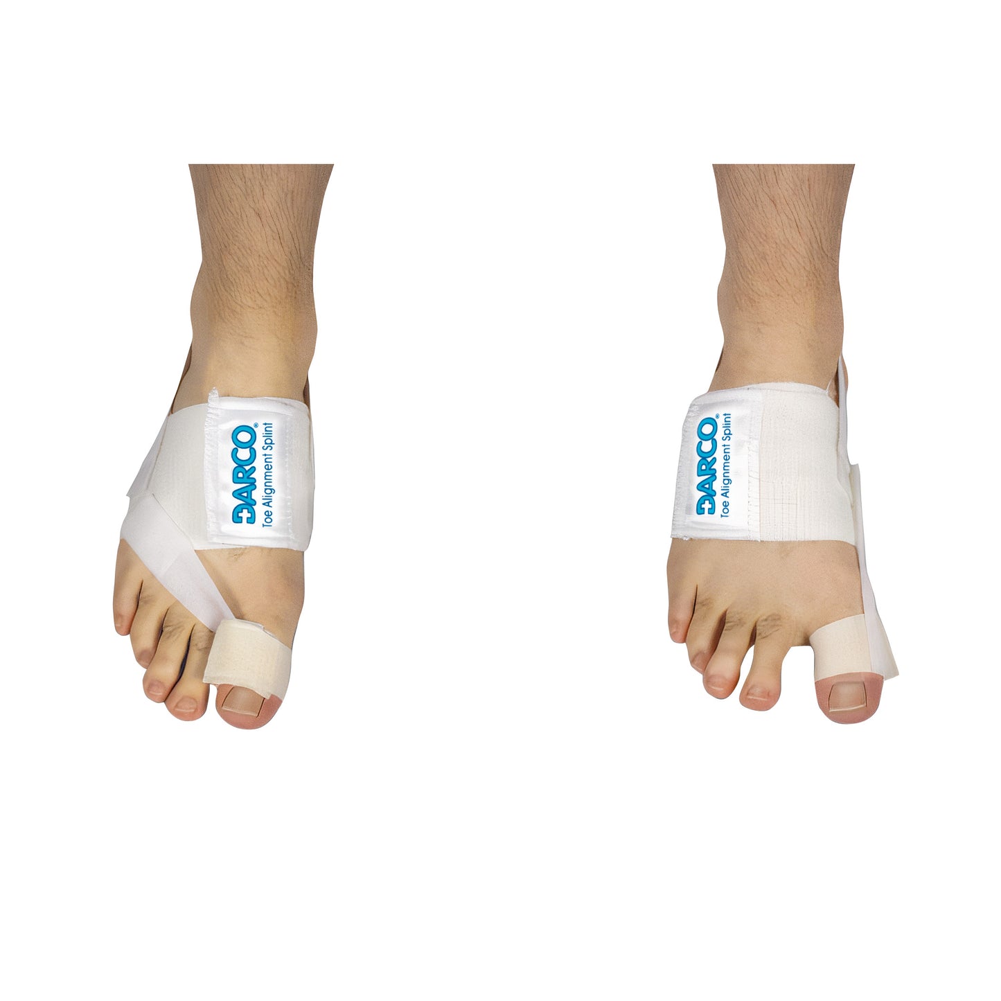 DARCO® Toe Alignment Splint