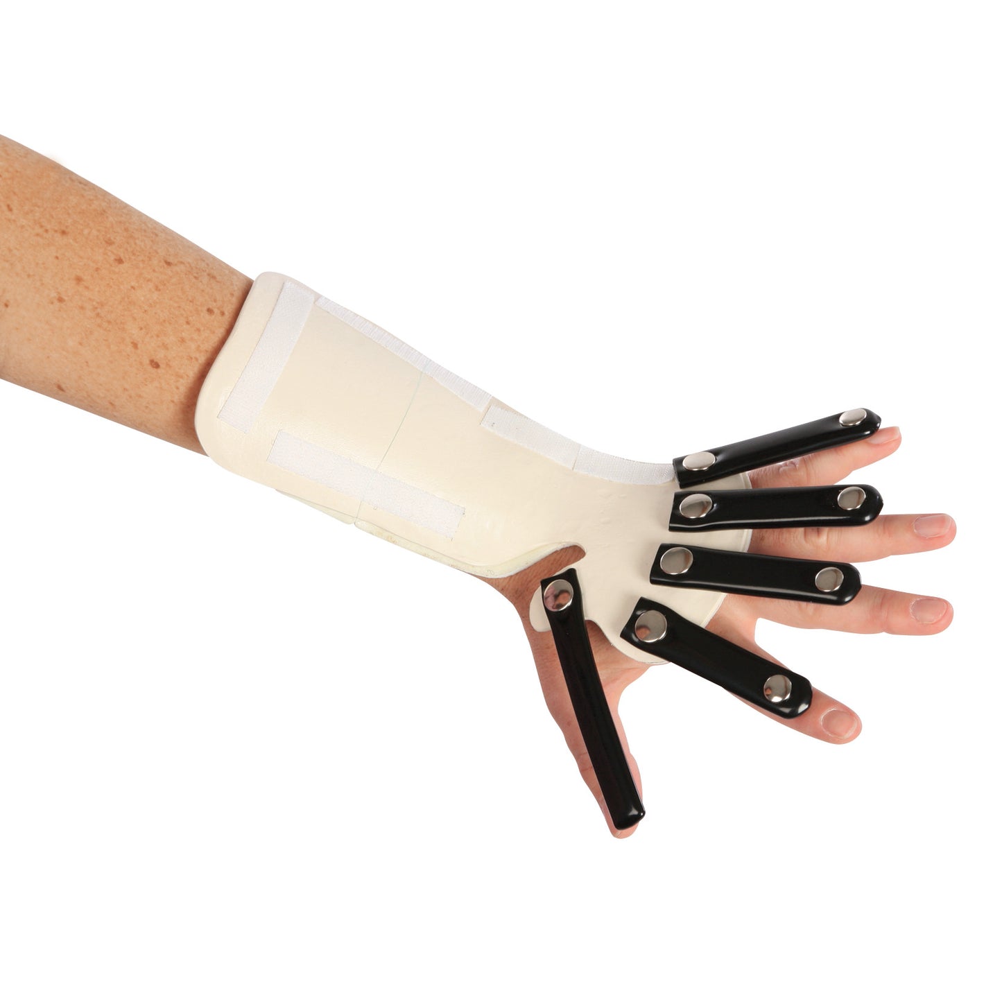 Forearm-Based Radial Nerve Splint, Left, X-Large