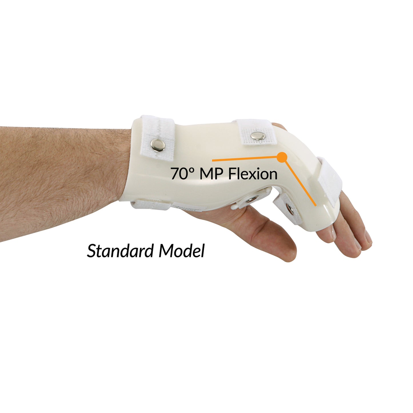 Boxer's Fracture Orthosis with MP Flexion, Standard, X-Large, Right