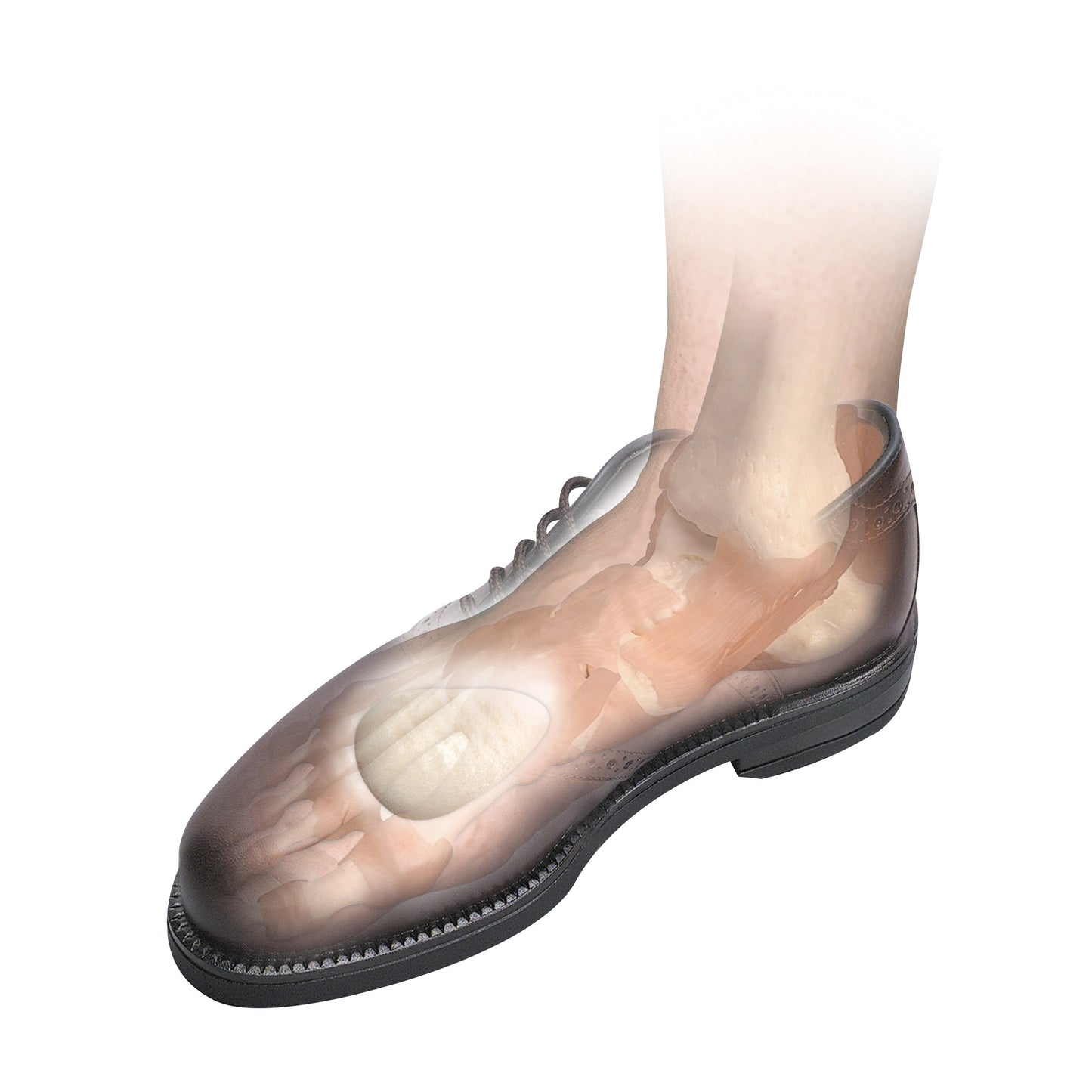 Metatarsal Pad, 1/4"H, Small, 6 Pair/Pack