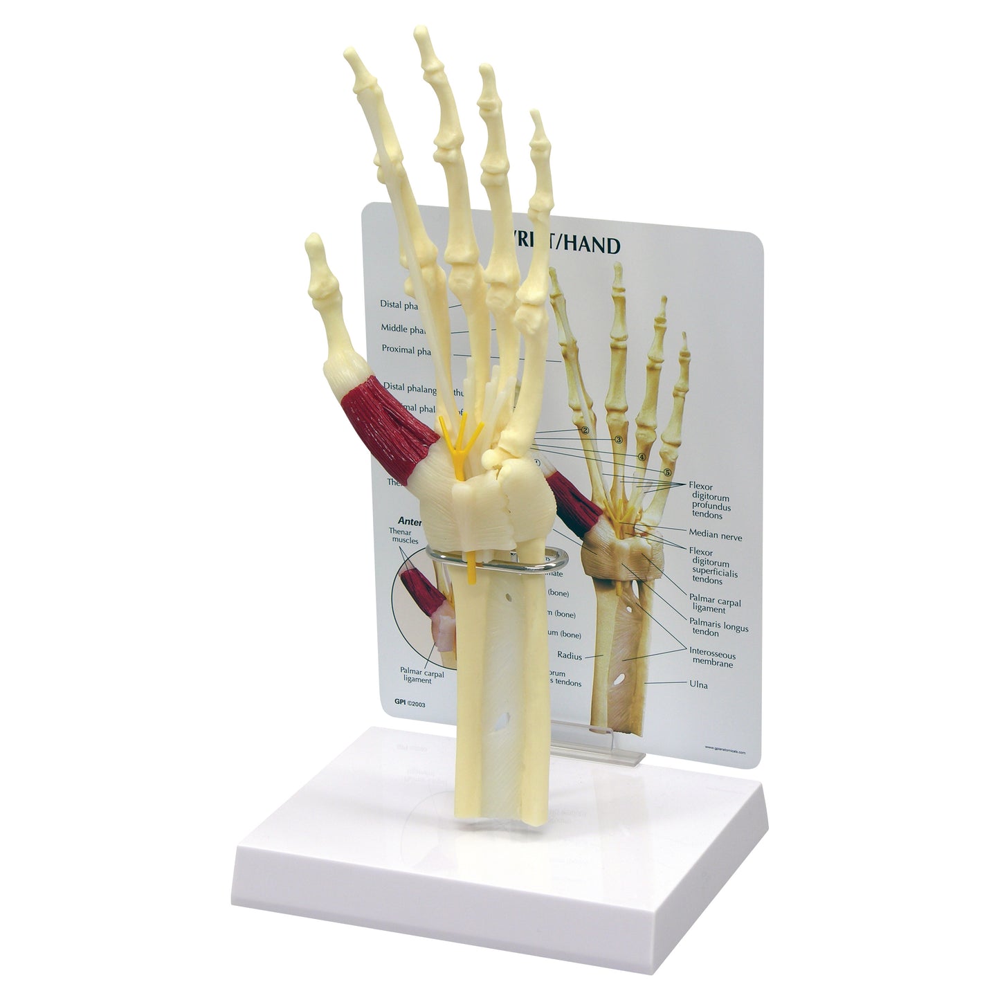 GPI Anatomicals® Wrist/Hand Carpal Tunnel Syndrome Model