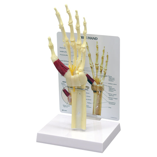 GPI Anatomicals® Wrist/Hand Carpal Tunnel Syndrome Model