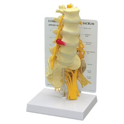 GPI Anatomicals® Lumbar with Sacrum Model