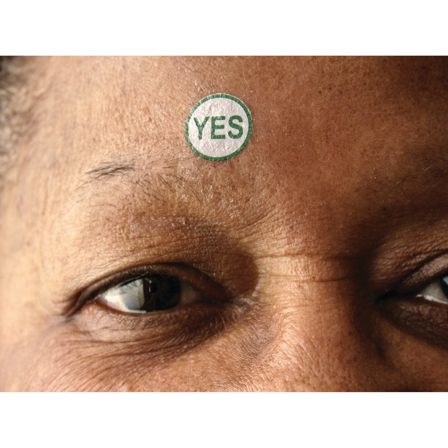 Viscot® TAT "YES" Marker