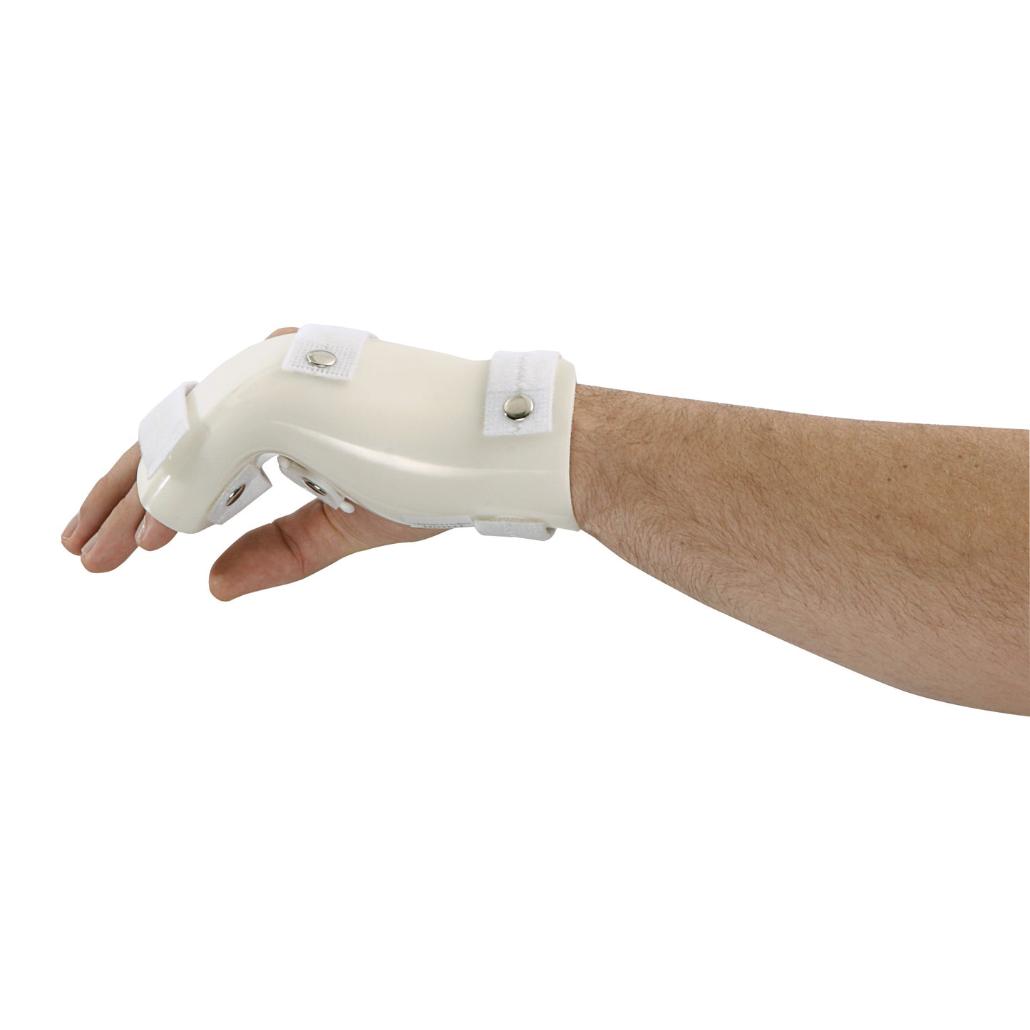 Boxer's Fracture Orthosis with MP Flexion, Standard, X-Large, Left