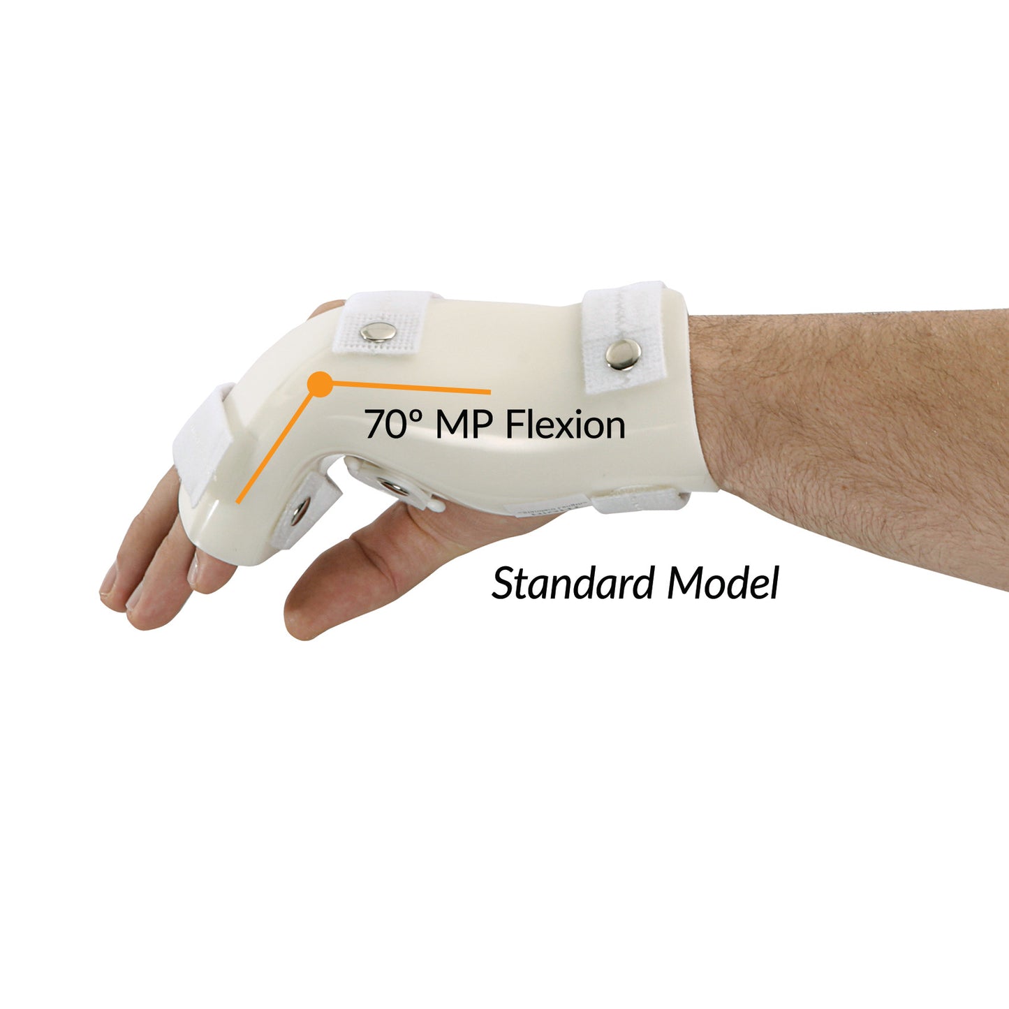 Boxer's Fracture Orthosis with MP Flexion, Standard, X-Large, Left