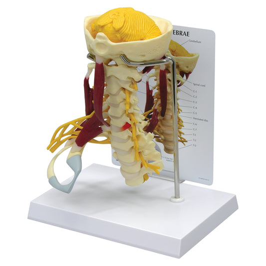 GPI Anatomicals® Muscled Cervical Model