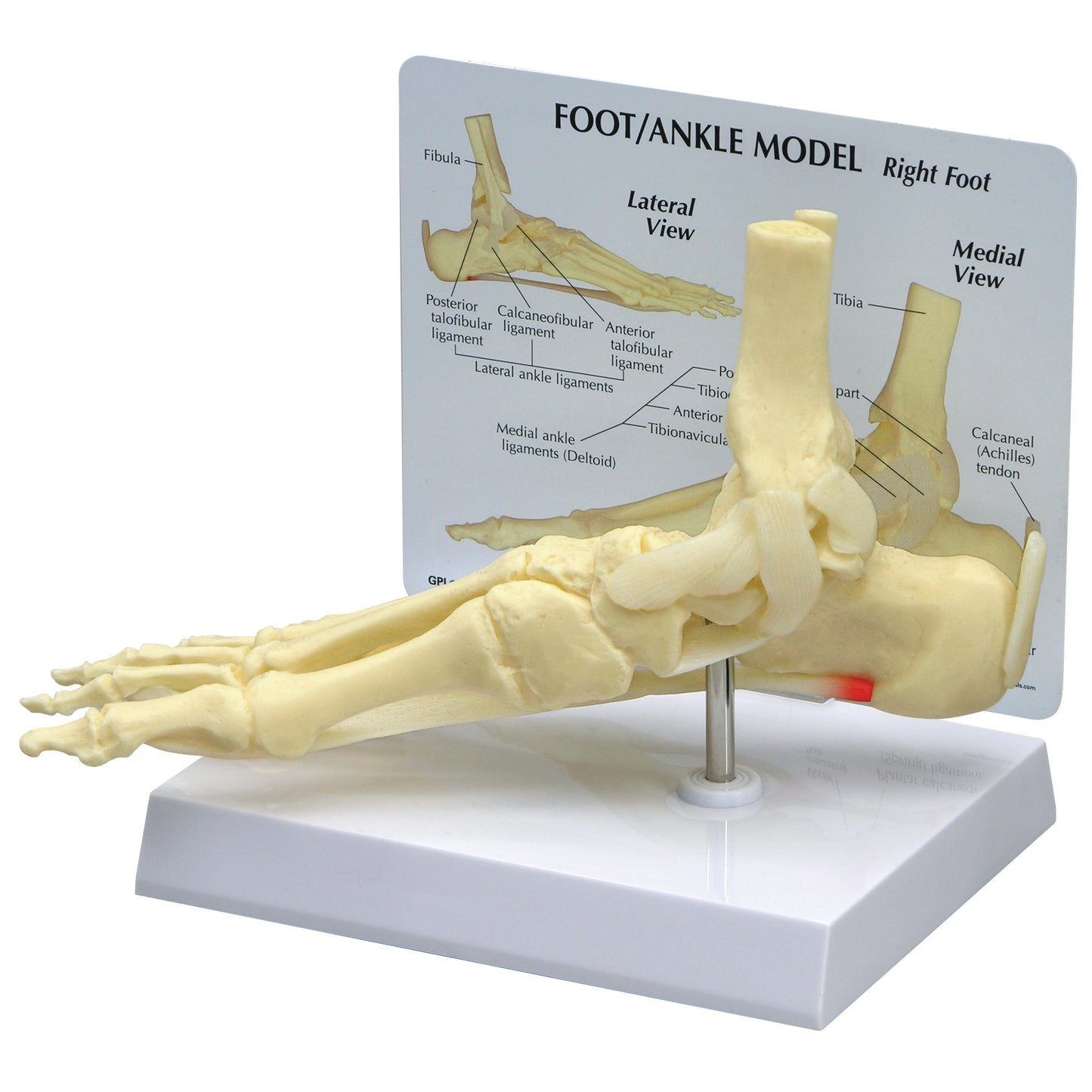 GPI Anatomicals® Foot/Ankle Plantar Fasciitis Model