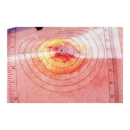 Disposable Wound Measuring Guide