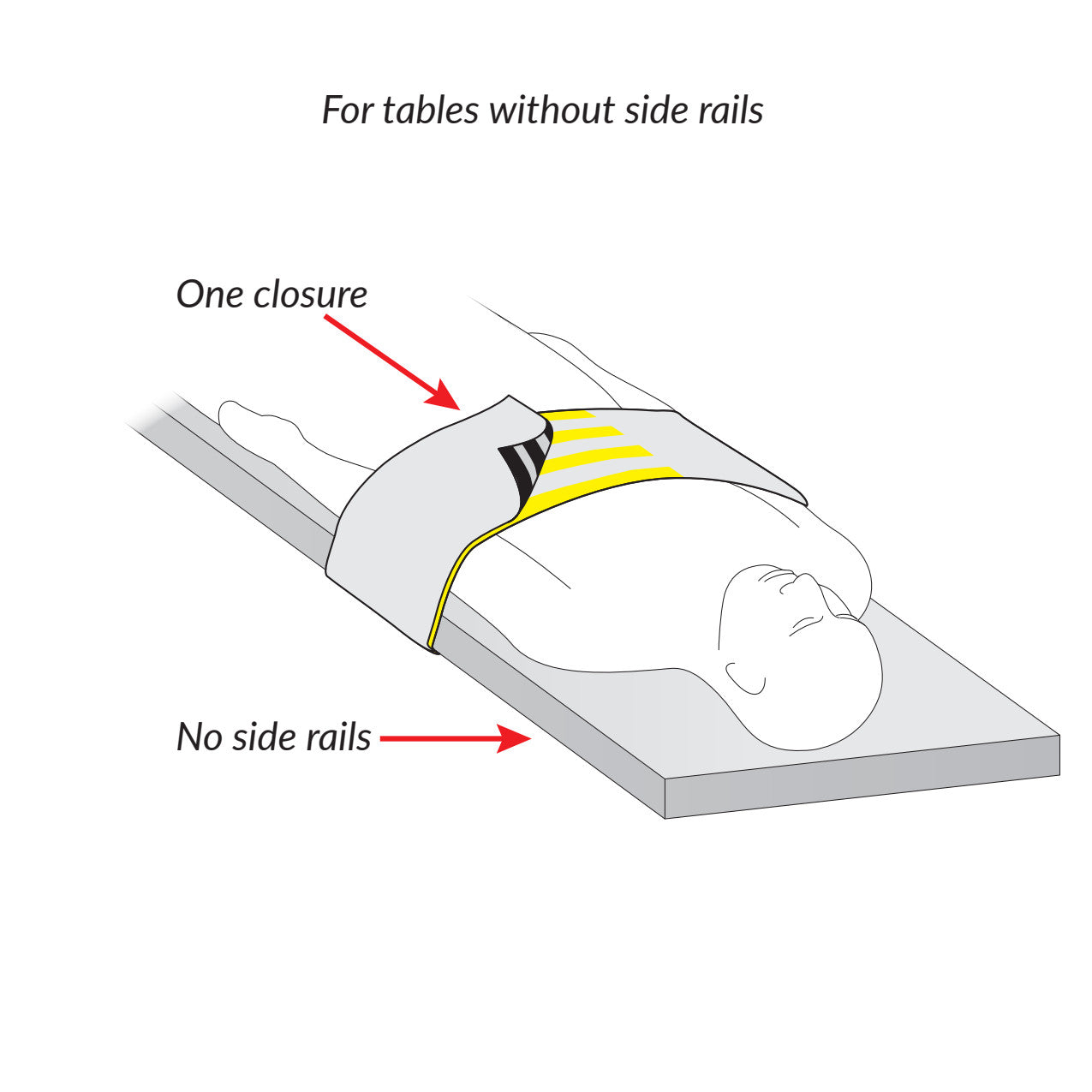 AliMed® Radiolucent Abdominal Immobilizer with One Closure