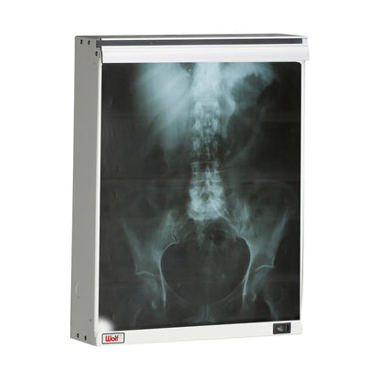 Econoline Illuminator, 1 Bank, Horizontal, 14"W x 17"H Viewing Area