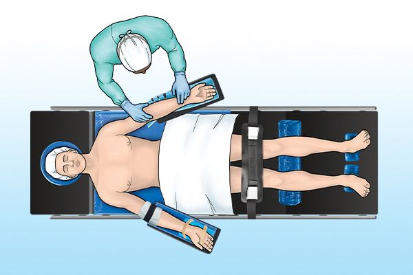 graphic of patient on operating table in supine position
