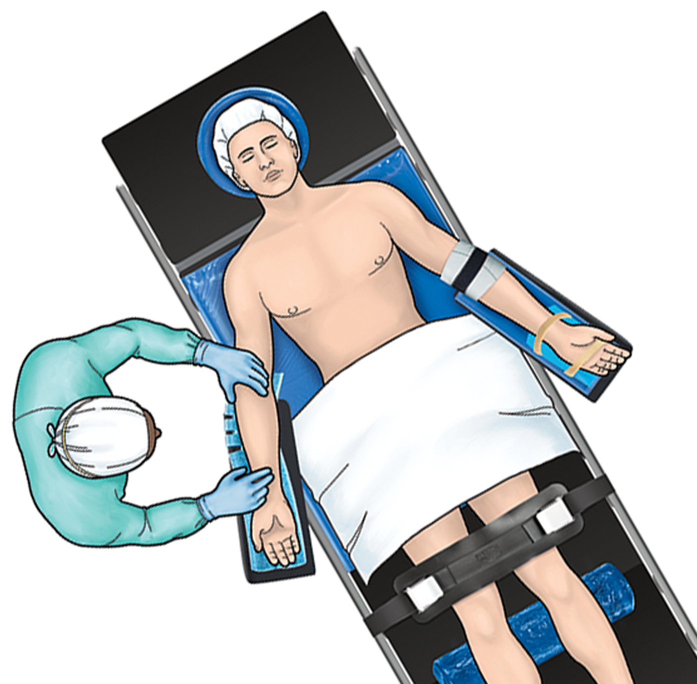 graphic of patient in supine position with aliblue positioners