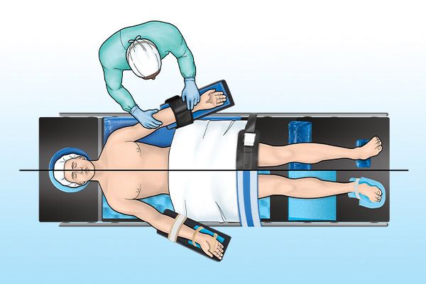 graphic of patient on operating table in supine position with disposable and reusable patient positioners