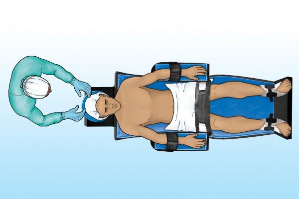 graphic of patient on operating table in fowlers position 