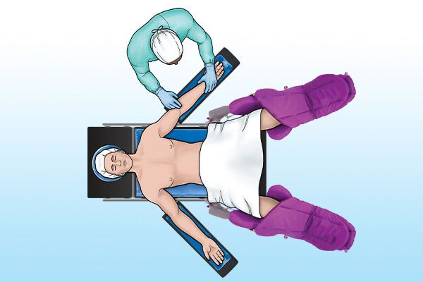 graphic of patient on operating table in lithotomy position 