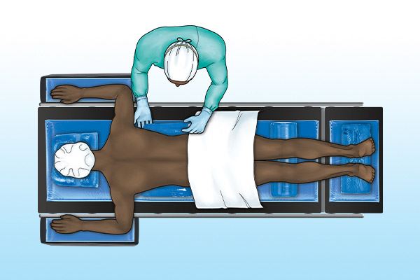 graphic of patient on operating table in prone position 
