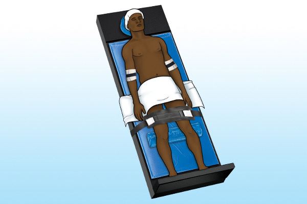 graphic of patient on operating table in reverse Trendelenburg position 
