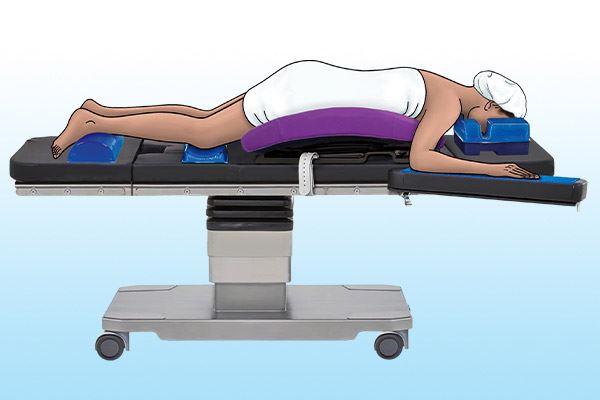 graphic of patient on operating table in spinal position 